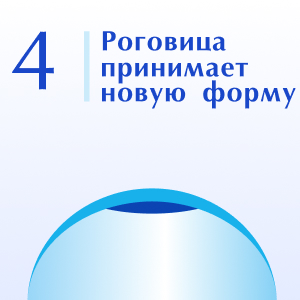 Роговица принимает новую форму Роговица принимает новую форму